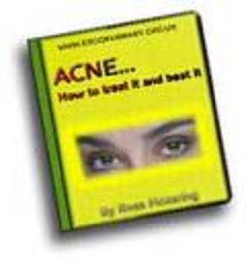 Product picture Acne - How to Treat It and Beat It